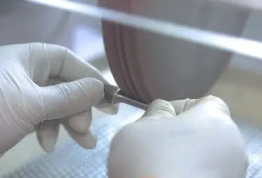Rotary-File-Polishing